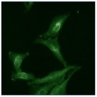 anti-AHA1, Activator of Heat Shock 90kDa Protein ATPase Homolog 1 (Yeast) (AHSA1) antibody avatar