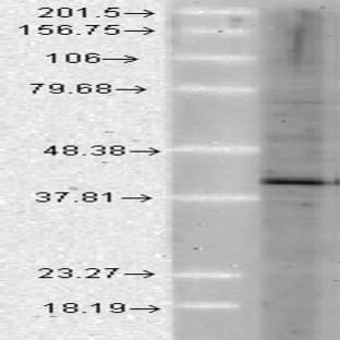 anti-AHA1, Activator of Heat Shock 90kDa Protein ATPase Homolog 1 (Yeast) (AHSA1) antibody avatar