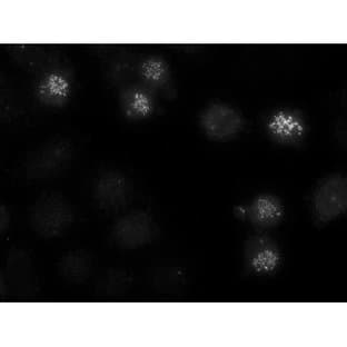 anti-Centromere Protein E, 312kDa (CENPE) antibody avatar