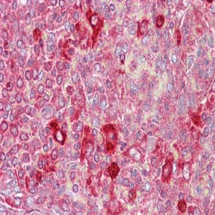 anti-CUGBP, Elav-Like Family Member 2 (CELF2) (N-Term) antibody avatar