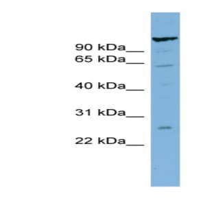 anti-Chromosome 6 Open Reading Frame 10 (C6ORF10) (Middle Region) antibody avatar