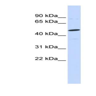 anti-Chondroitin Sulfate Proteoglycan 5 (Neuroglycan C) (CSPG5) (N-Term) antibody avatar