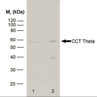 anti-Chaperonin Containing TCP1, Subunit 8 (Theta) (CCT8) antibody avatar