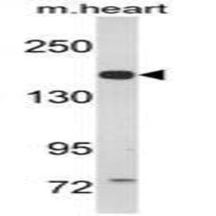 anti-Corin, Serine Peptidase (CORIN) (Middle Region) antibody avatar
