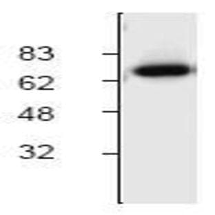 anti-Cholesteryl Ester Transfer Protein (CETP) (C-Term) antibody avatar