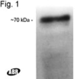 anti-Cholesteryl Ester Transfer Protein (CETP) (C-Term), (AA 131-142) antibody avatar