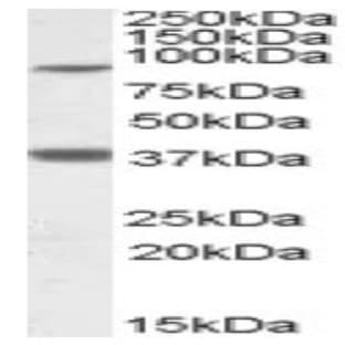 anti-Ceramide Synthase 1 (CERS1) (Internal Region) antibody avatar