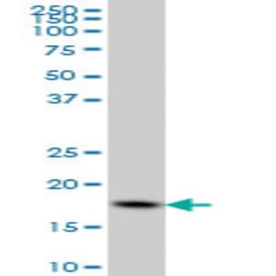 anti-Cofilin 1 (Non-Muscle) (CFL1) (AA 1-167) antibody avatar