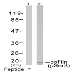 anti-Cofilin 1 (Non-Muscle) (CFL1) (pSer3) antibody avatar