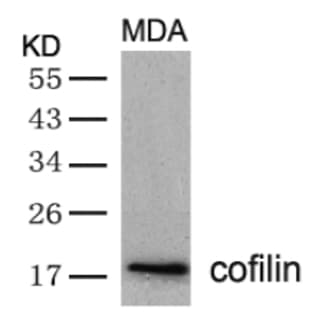 anti-Cofilin 1 (Non-Muscle) (CFL1) (AA 1-5), (N-Term) antibody avatar