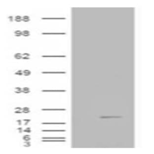 anti-Cofilin 2 (Muscle) (CFL2) (C-Term) antibody avatar