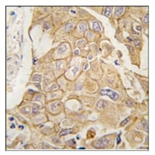 anti-Adenylate Cyclase 2 (Brain) (ADCY2) (C-Term) antibody avatar
