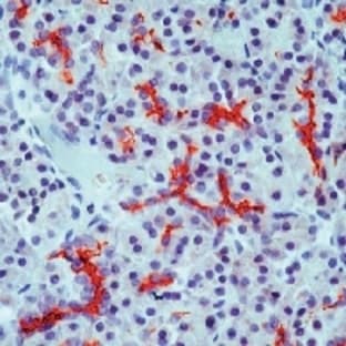 anti-Cystic Fibrosis Transmembrane Conductance Regulator (ATP-Binding Cassette Sub-Family C, Member 7) (CFTR) antibody avatar