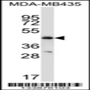 anti-Chemokine (C-C Motif) Receptor 9 (CCR9) (C-Term), (AA 306-334) antibody avatar