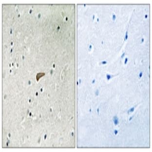 anti-Fibroblast Growth Factor Receptor Substrate 2 (FRS2) (pTyr436) antibody avatar