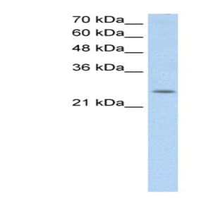 anti-Chromosome 5 Open Reading Frame 4 (C5orf4) (N-Term) antibody avatar