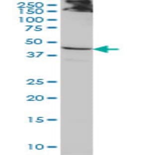 anti-Actin-Like 7b (Actl7b) (AA 286-378) antibody avatar