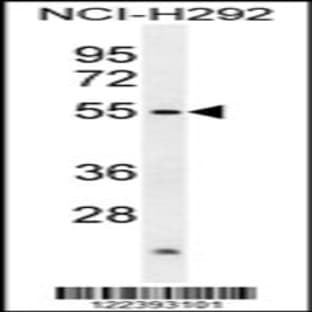anti-Actin-Like 7A (ACTL7A) (N-Term), (AA 41-67) antibody avatar
