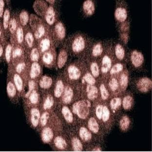 anti-COP9 Constitutive Photomorphogenic Homolog Subunit 5 (Arabidopsis) (COPS5) (AA 234-334) antibody avatar