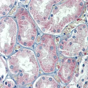 anti-Solute Carrier Family 27 (Fatty Acid Transporter), Member 2 (SLC27A2) (N-Term) antibody avatar