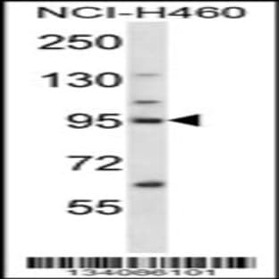 anti-Kinesin Family Member 2C (KIF2C) (N-Term), (AA 180-208) antibody avatar