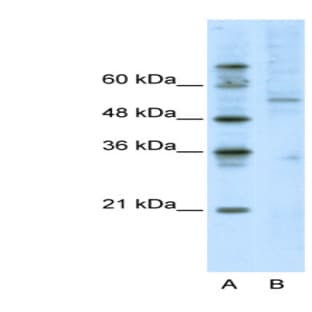 anti-Activating Transcription Factor 7 (AFT7) (C-Term) antibody avatar