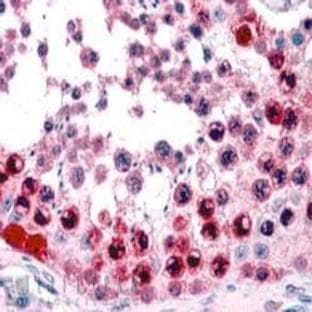 anti-Activating Transcription Factor 7 (AFT7) (C-Term) antibody avatar