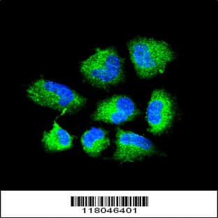 anti-Choline O-Acetyltransferase (CHAT) (N-Term), (AA 98-128) antibody avatar