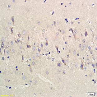 anti-Choline O-Acetyltransferase (CHAT) antibody avatar