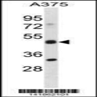 anti-Adhesion Regulating Molecule 1 (Adrm1) (C-Term), (AA 368-397) antibody avatar