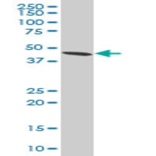 anti-Adhesion Regulating Molecule 1 (Adrm1) (AA 18-408) antibody avatar