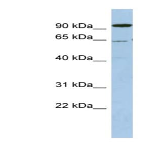 anti-DEAD (Asp-Glu-Ala-Asp) Box Polypeptide 52 (DDX52) (N-Term) antibody avatar