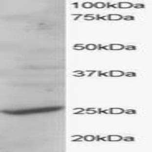 anti-Cytochrome B-561 Domain Containing 2 (CYB561D2) (C-Term) antibody avatar