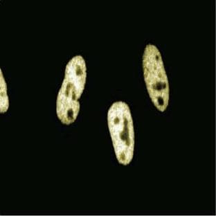 anti-Chromodomain Helicase DNA Binding Protein 3 (CHD3) (AA 1277-1474) antibody avatar
