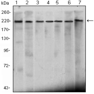 anti-Chromodomain Helicase DNA Binding Protein 3 (CHD3) antibody avatar