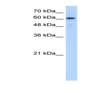anti-ADAM Metallopeptidase Domain 30 (ADAM30) (N-Term) antibody avatar
