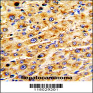 anti-ADAM Metallopeptidase with Thrombospondin Type 1 Motif, 13 (ADAMTS13) (AA 829-858), (Center) antibody avatar