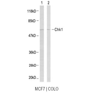anti-Checkpoint Kinase 1 (CHEK1) (Ser317) antibody avatar