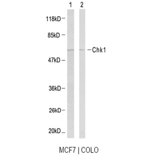 anti-Checkpoint Kinase 1 (CHEK1) (Ser317) antibody avatar