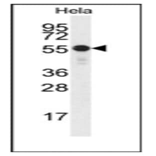 anti-Checkpoint Kinase 1 (CHEK1) antibody avatar