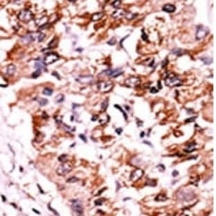 anti-Checkpoint Kinase 1 (CHEK1) (pSer317) antibody avatar