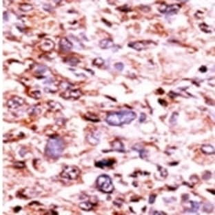 anti-Checkpoint Kinase 1 (CHEK1) (pSer280) antibody avatar