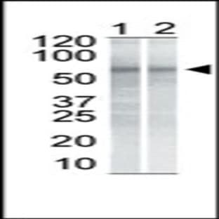 anti-Checkpoint Kinase 1 (CHEK1) antibody avatar