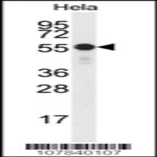 anti-Checkpoint Kinase 1 (CHEK1) (AA 258-287), (Ser280) antibody avatar