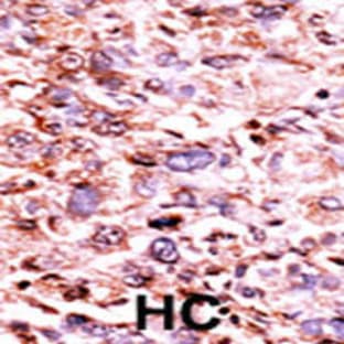 anti-Checkpoint Kinase 1 (CHEK1) (pSer280) antibody avatar