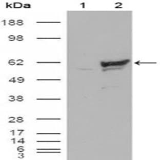anti-Checkpoint Kinase 1 (CHEK1) antibody avatar