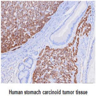 anti-Chromogranin A (CHGA) (AA 19-131) antibody avatar