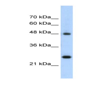 anti-Chromogranin A (CHGA) (N-Term) antibody avatar