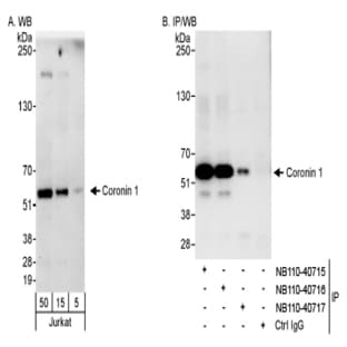 anti-Coronin, Actin Binding Protein, 1A (CORO1A) antibody avatar