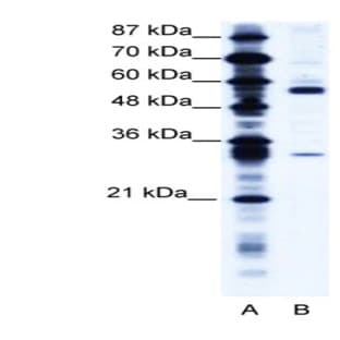 anti-Coronin, Actin Binding Protein, 1A (CORO1A) (C-Term) antibody avatar